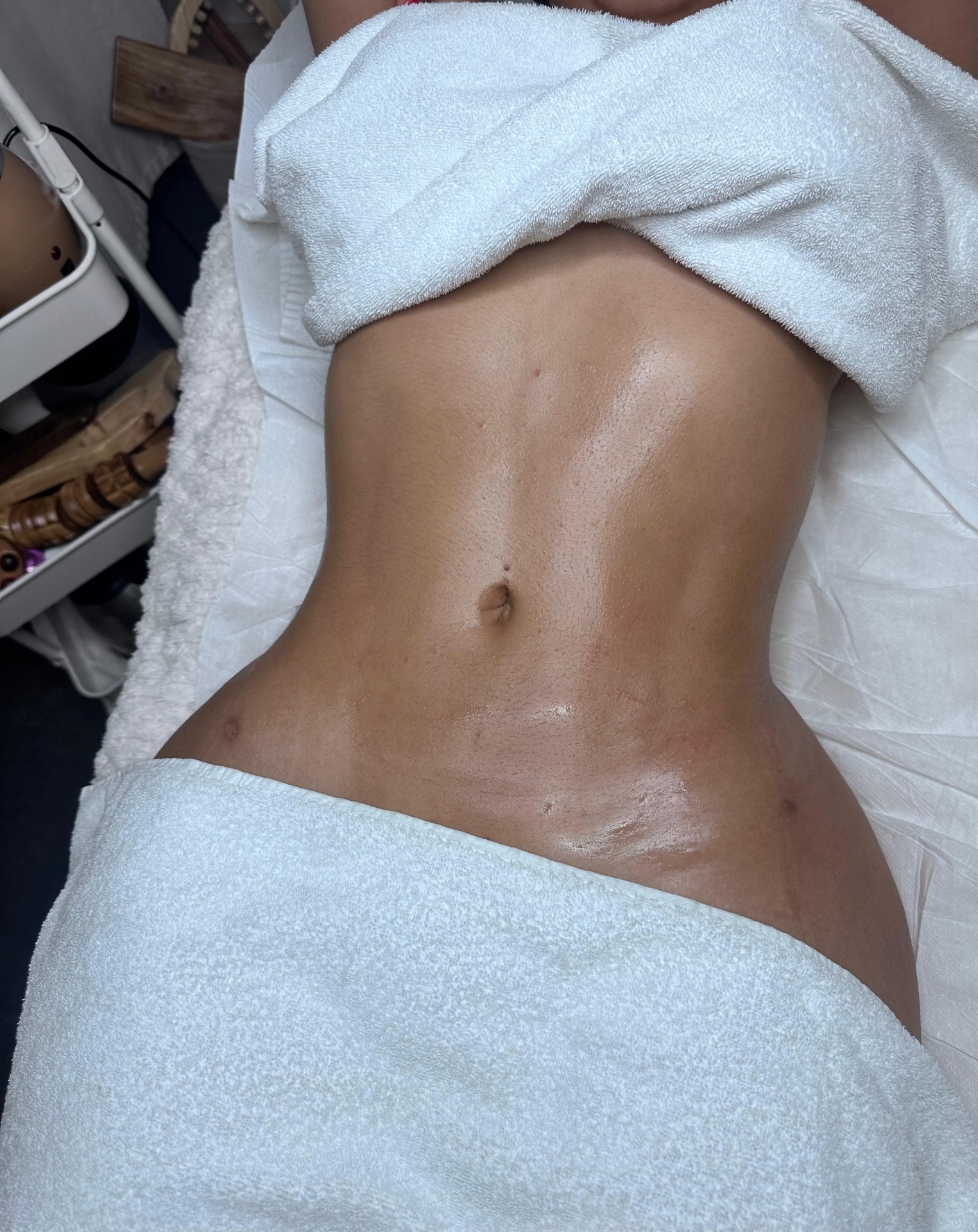 Post-lipo massage
